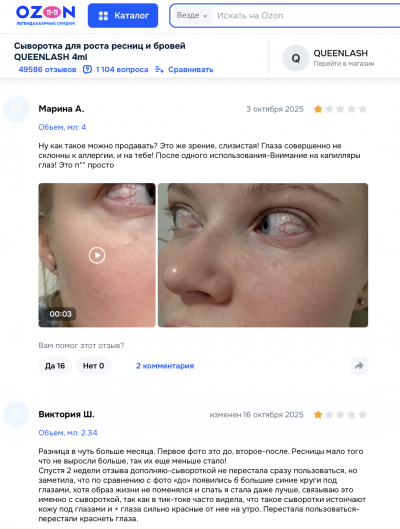 Queenlash отзывы: за красивыми ресницами может скрываться опасность для глаз